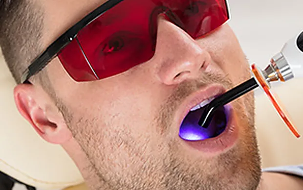 Composite filling treatment under a curing light.